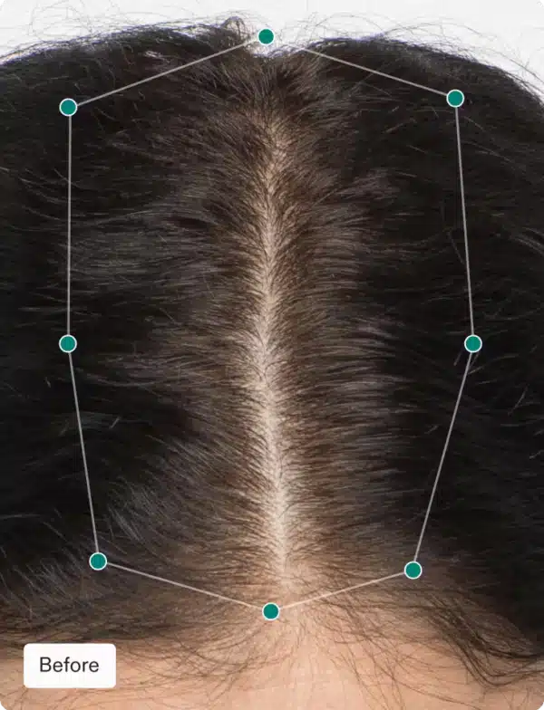 Nutrafol Women - Image 5