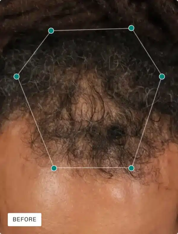 NUTRAFOL MEN - Image 5