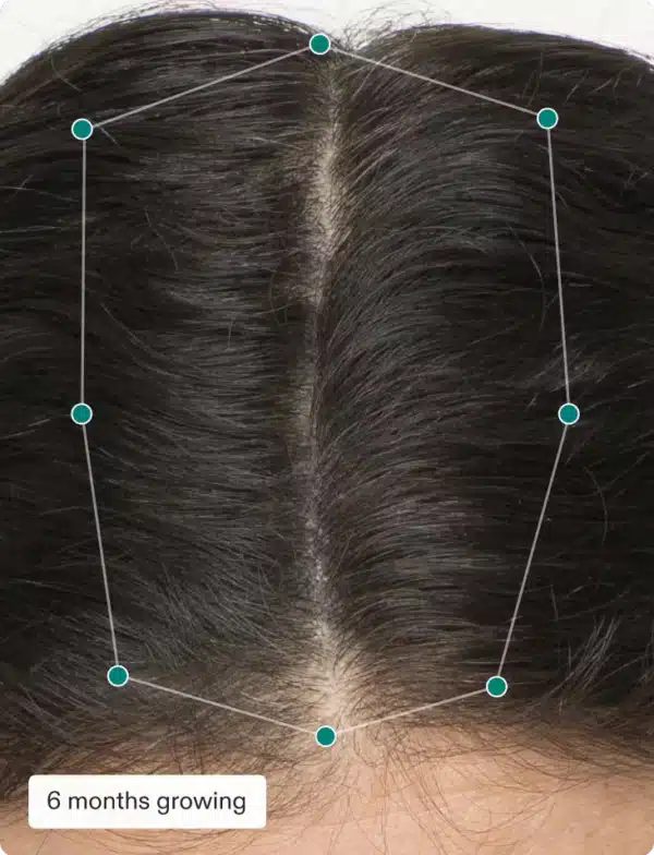 Nutrafol Women - Image 4
