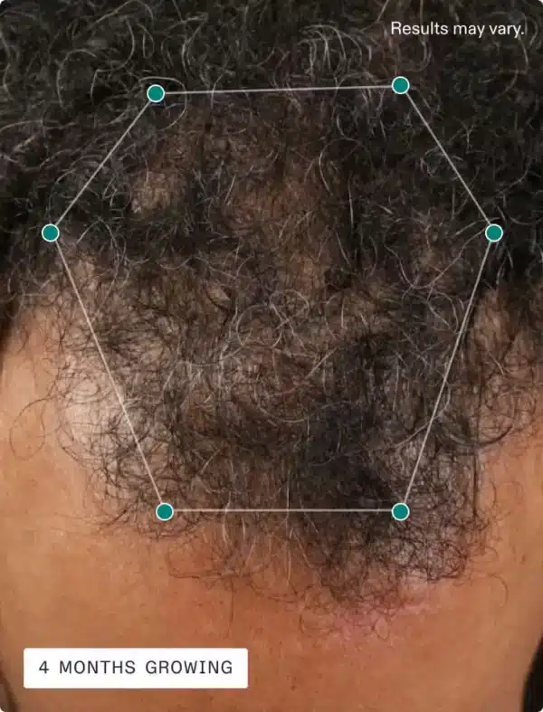 NUTRAFOL MEN - Image 6