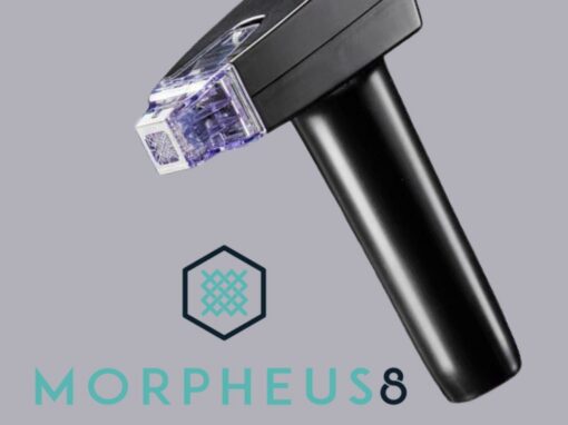 Unlocking Youthful Skin: The Remarkable Benefits of RF Microneedling with Morpheus8 Unlocking Youthful Skin: The Remarkable Benefits of RF Microneedling with Morpheus8