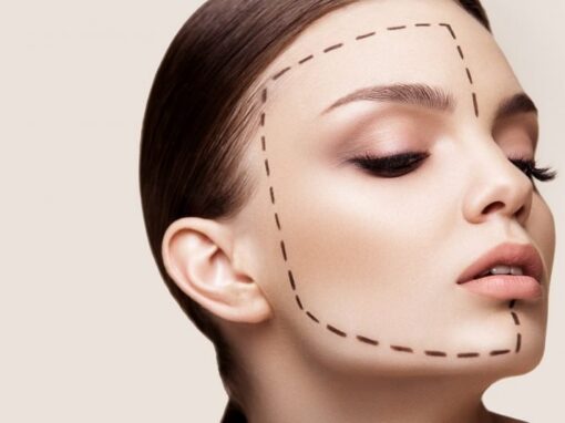 Is a Facelift Right for You? Making an Informed Decision Is a Facelift Right for You? Making an Informed Decision