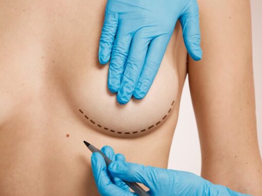 Understanding the Difference Between a Breast Lift and Breast Reduction Understanding the Difference Between a Breast Lift and Breast Reduction