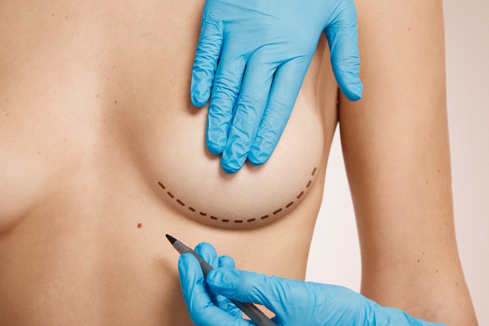 Understanding the Difference Between a Breast Lift and Breast Reduction