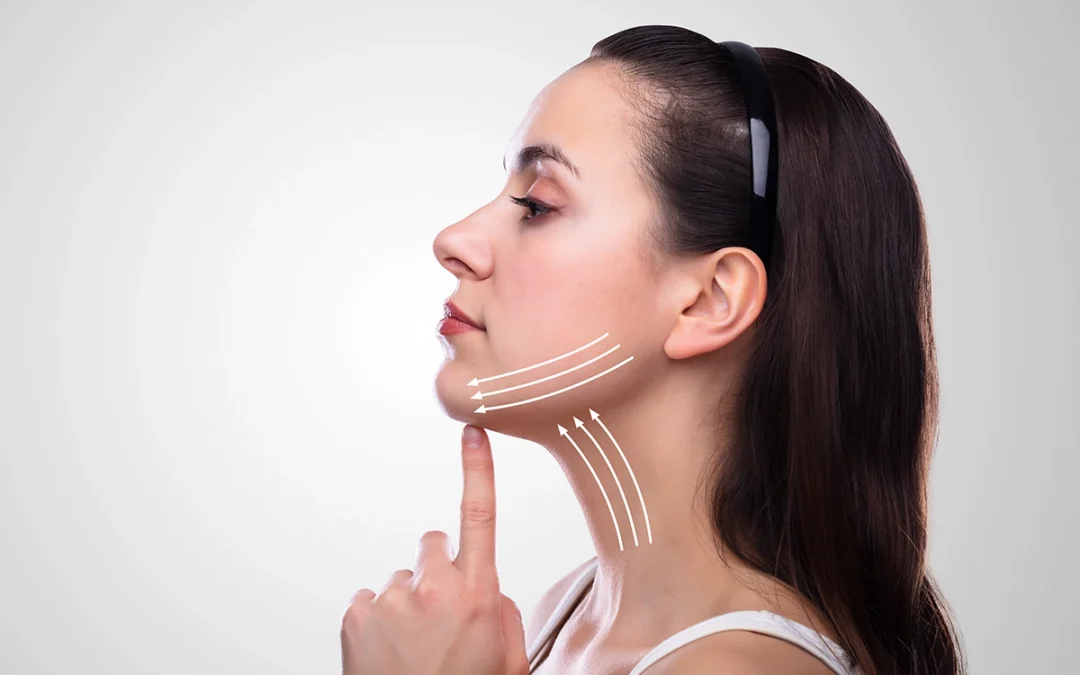 woman after face lifting on her face