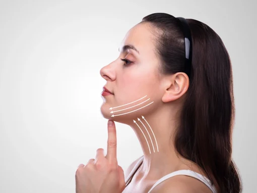 Submental Liposuction: Enhancing Your Profile from Every Angle Submental Liposuction: Enhancing Your Profile from Every Angle